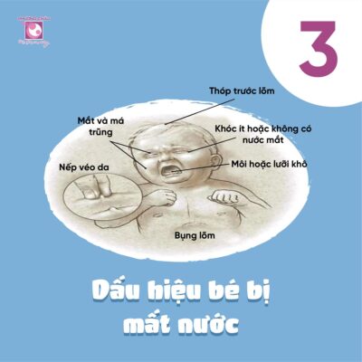 dấu hiệu trẻ bị mất nước