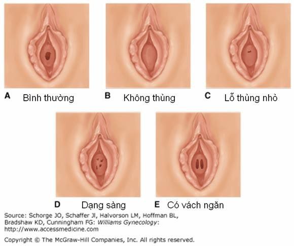 cac-ton-thuong-lanh-tinh-thuong-gap-o-am-ho-am-dao-bit-mang-trinh