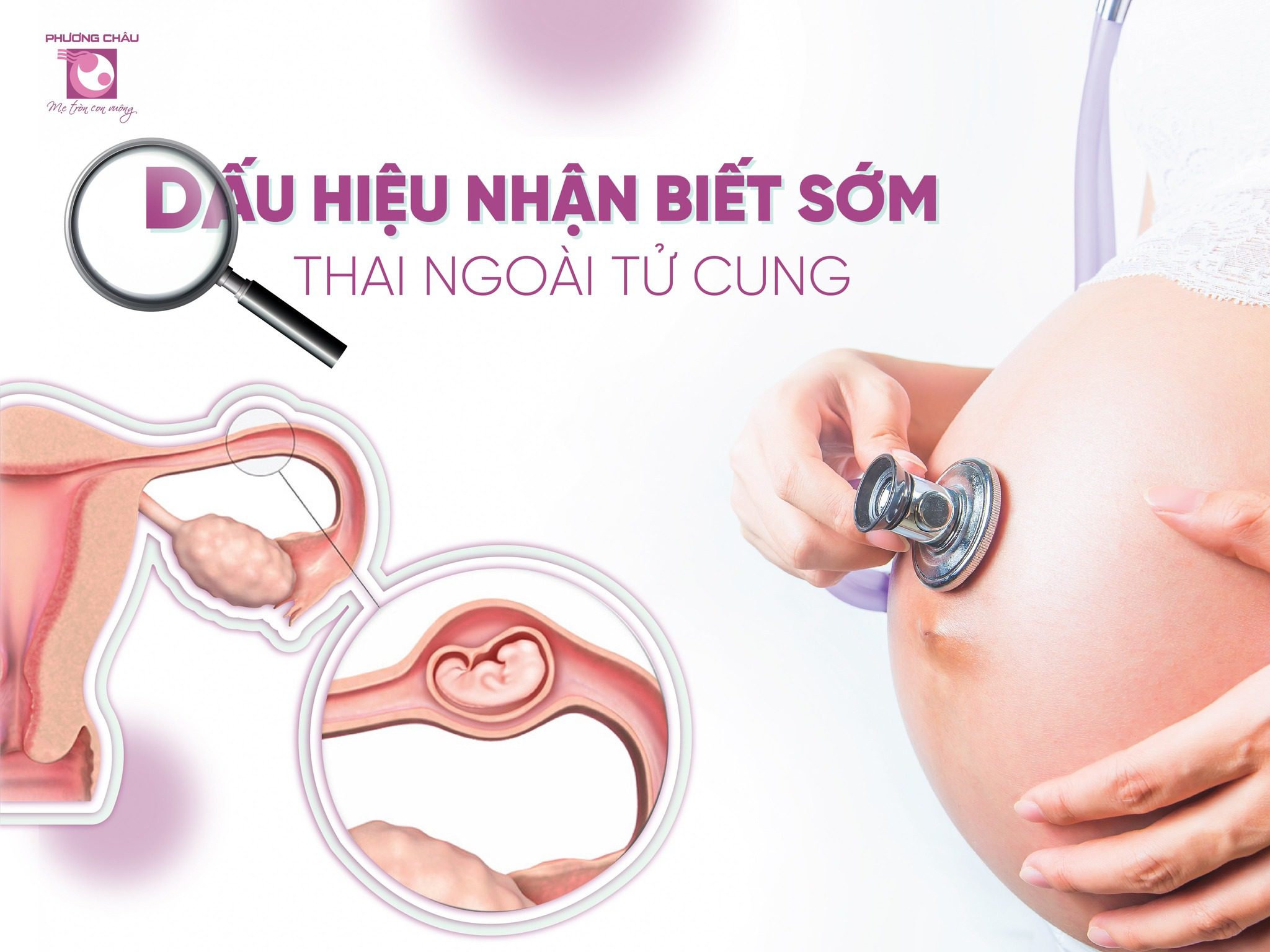 4. Chẩn đoán và theo dõi