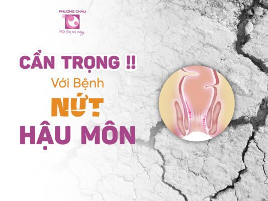 nứt hậu môn